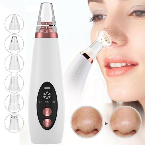 d8748a8e-9650-4fd5-8a8e-0209df2c032a.jpg Blackhead Remover Vacuum – Electric Pore Cleaner Tool